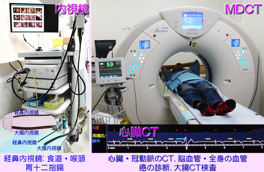 MDCT・内視鏡