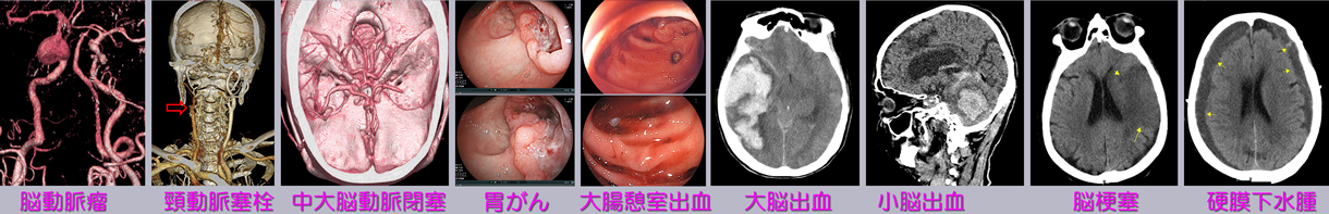 診断例